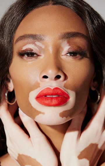 Шантель Браун-Янг / Winnie Harlow