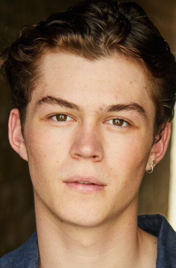  / Zac Burgess