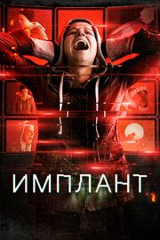 Имплантированная 